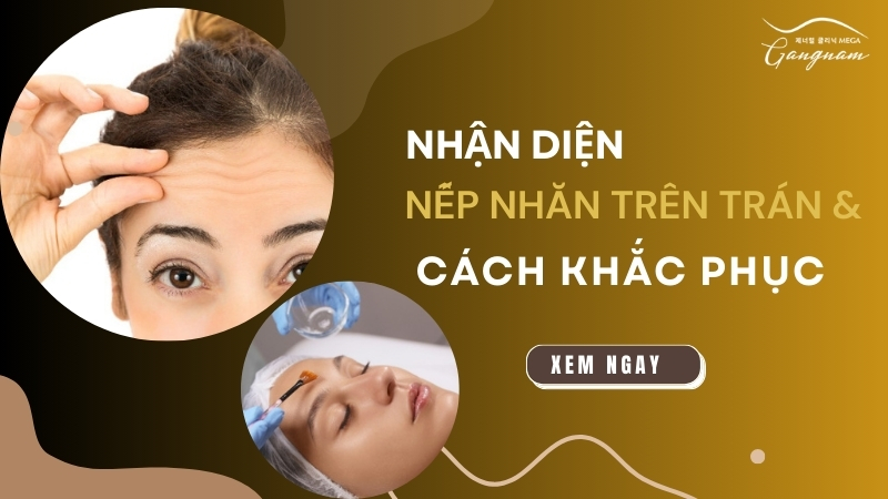 Nhận diện nếp nhăn trên trán và giải pháp khắc phục