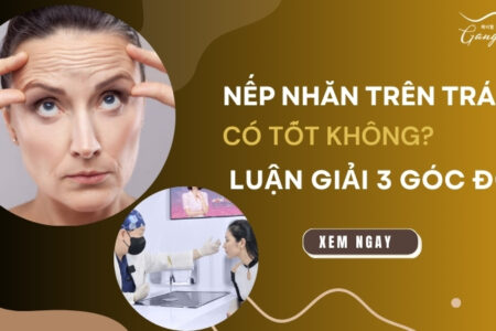 Nếp nhăn trên trán có tốt không? Luận giải 3 góc độ