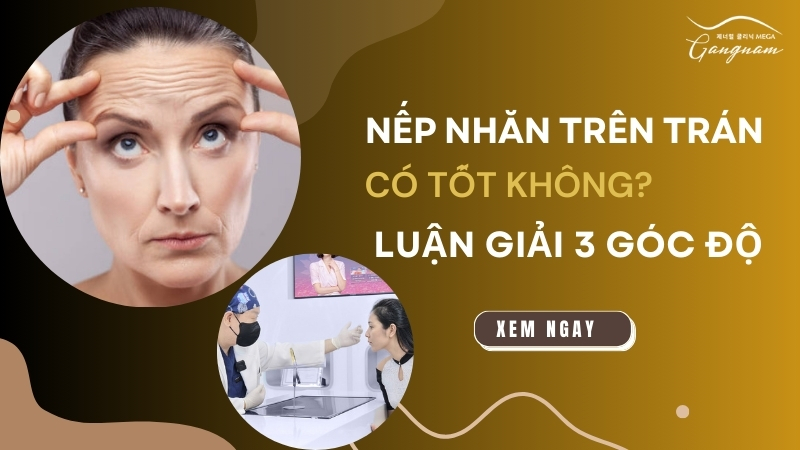 Nếp nhăn trên trán có tốt không? Luận giải 3 góc độ