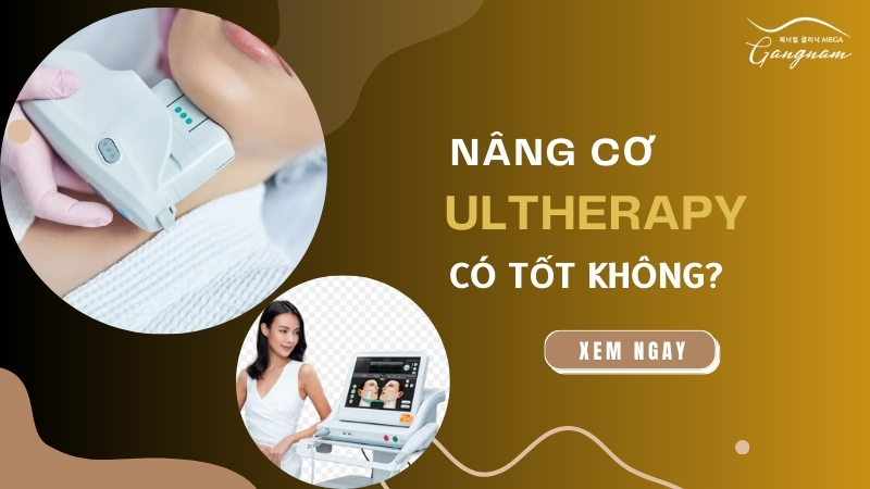 Nâng cơ Ultherapy có tốt không?