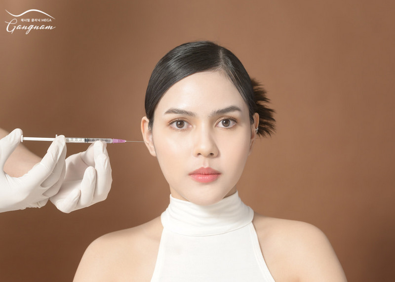 Filler Hàn Quốc nằm trong số các dòng filler cao cấp hiệu quả đẹp vượt trội 