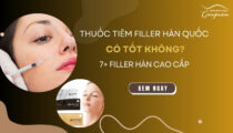 Thuốc tiêm filler Hàn Quốc có tốt không? 7+ loại filler Hàn cao cấp