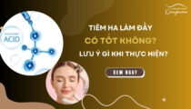 Tiêm HA làm đầy có tốt không? Lưu ý gì khi thực hiện?