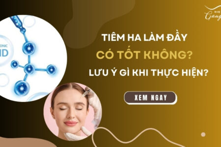 Tiêm HA làm đầy có tốt không? Lưu ý gì khi thực hiện?