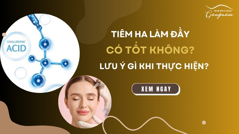 Tiêm HA làm đầy có tốt không? Lưu ý gì khi thực hiện?