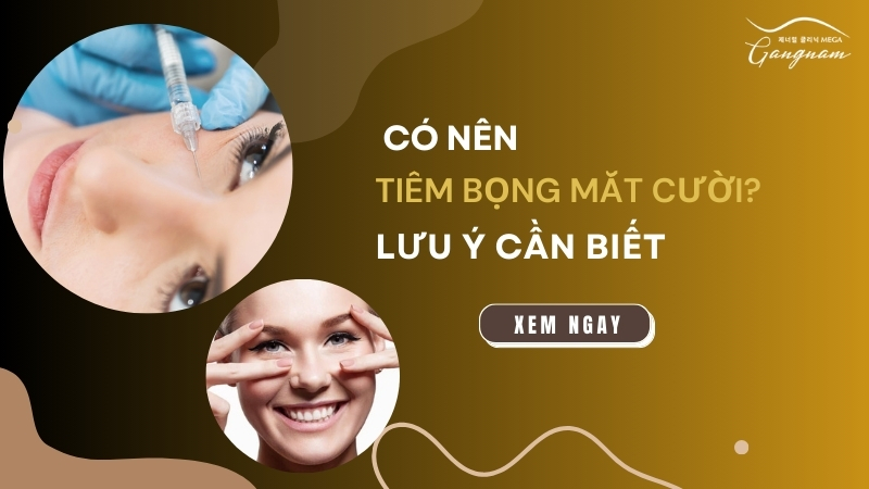 Tiêm bọng mắt cười có nên hay không? 