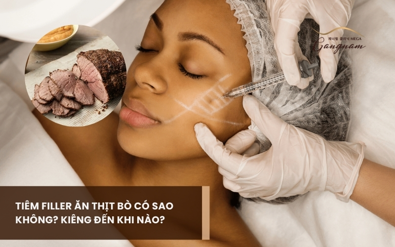 Sau khi tiêm filler ăn thịt bò có sao không? Nên kiêng ăn đến bao giờ? 