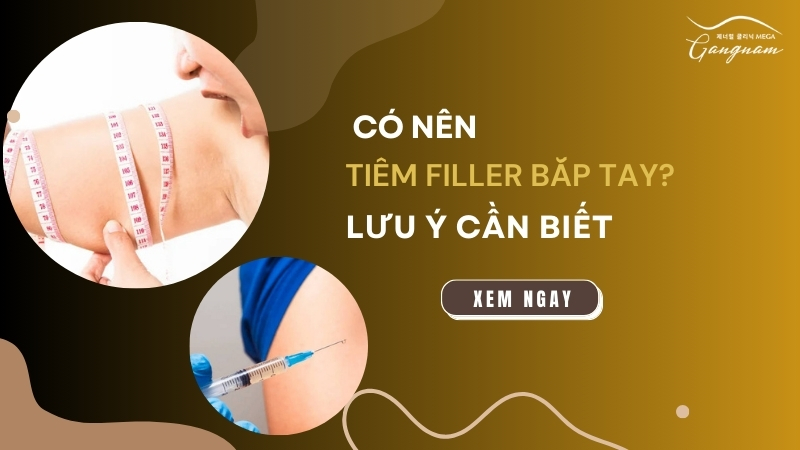 Tiêm filler bắp tay có nên hay không?