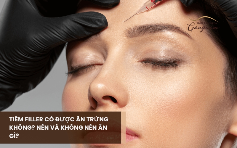 Bác sĩ giải đáp như thế nào về việc tiêm filler có được ăn trứng không? Lý do là gì? 