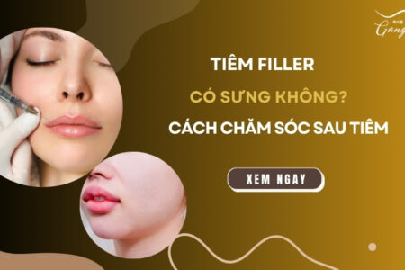 Tiêm filler có sưng không và lưu ý cách chăm sóc