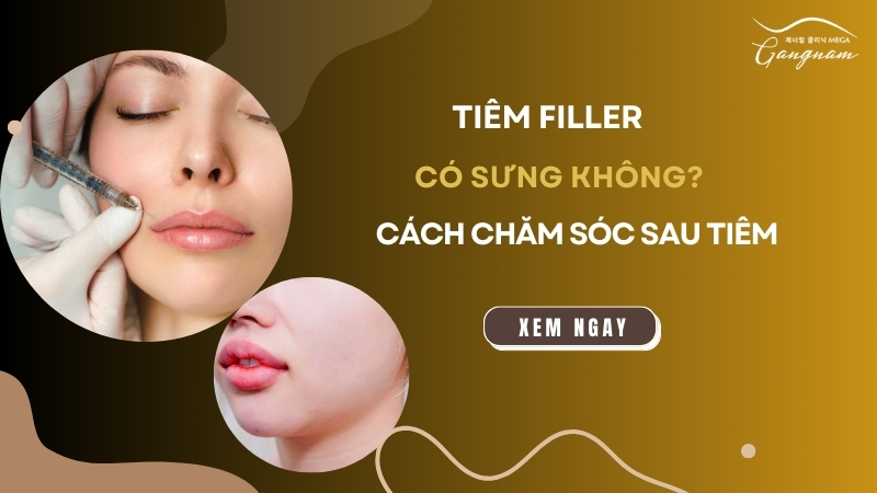 Tiêm filler có sưng không và lưu ý cách chăm sóc