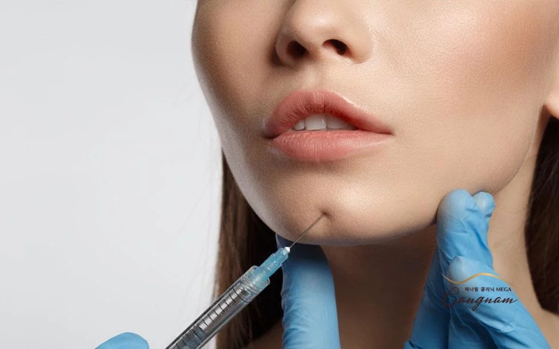 Tiêm filler không phải giải pháp được khuyến nghị với những người muốn thu nhỏ và gọn hàm 