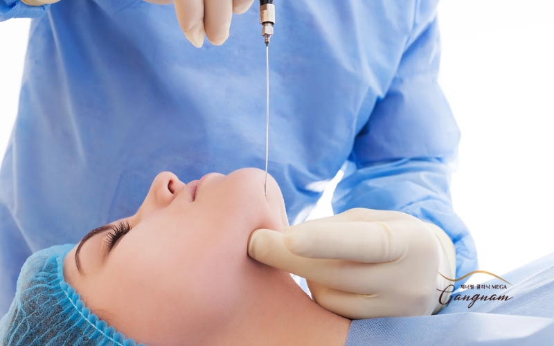 Hút mỡ cằm có thể được áp dụng trong một số trường hợp không đáp ứng botox hoặc không muốn phẫu thuật 