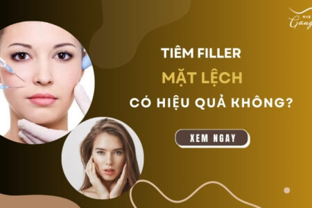 Tiêm filler mặt lệch có hiệu quả không?