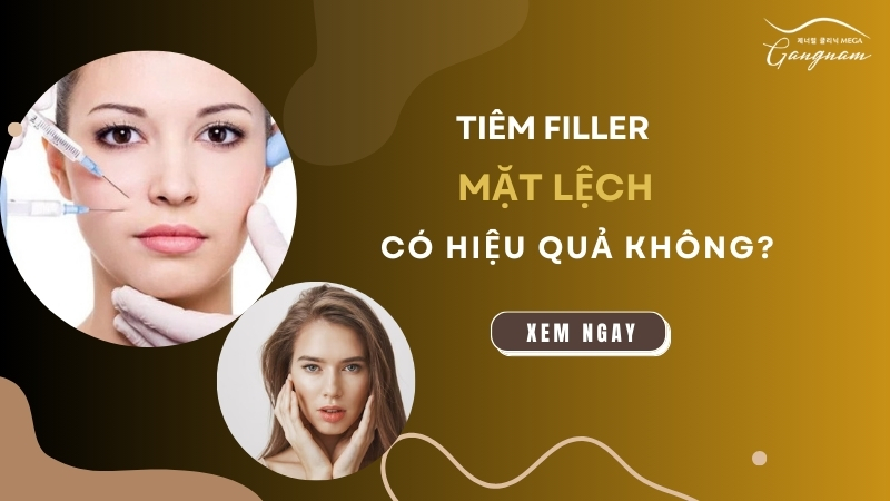 Tiêm filler mặt lệch có hiệu quả không?