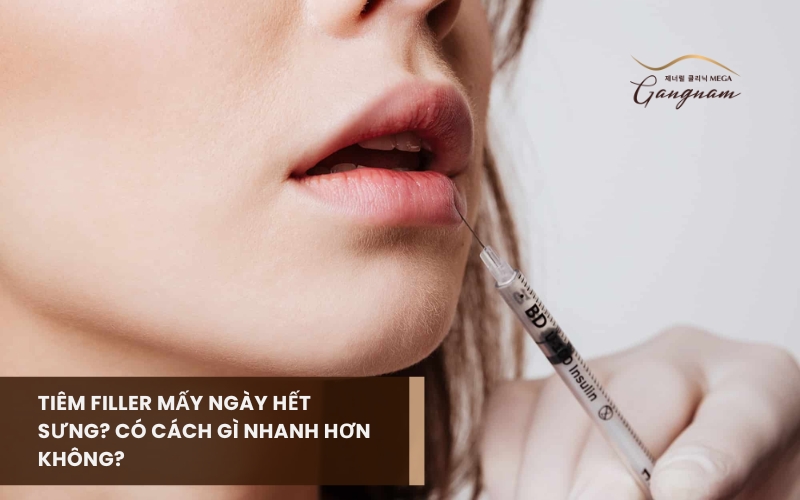 Giải đáp tiêm filler mấy ngày hết sưng và làm sao để khu vực tiêm nhanh hồi phục, giảm sưng tấy? 