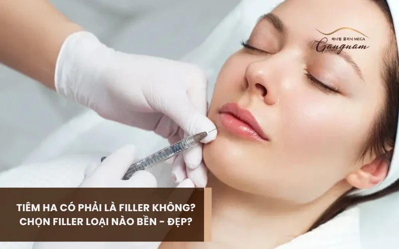 Giải đáp chi tiết tiêm HA có phải là filler không? Tại sao? 