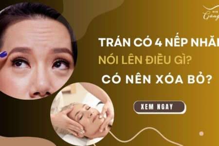 Trán có 4 nếp nhăn nói lên điều gì? Có nên xóa bỏ không?