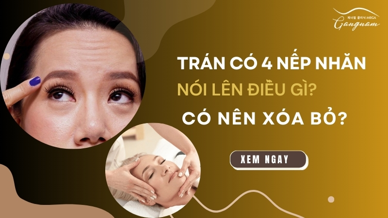 Trán có 4 nếp nhăn nói lên điều gì? Có nên xóa bỏ không?