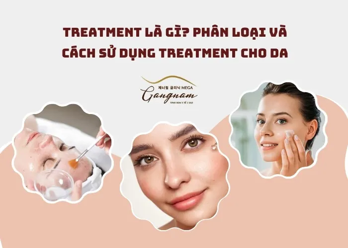 Treatment là gì?