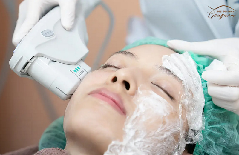 Nâng cơ mặt bằng Ultherapy có mức độ an toàn tuyệt đối theo chuẩn FDA