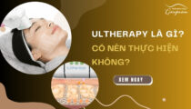 Ultherapy là gì? Có nên thực hiện không?