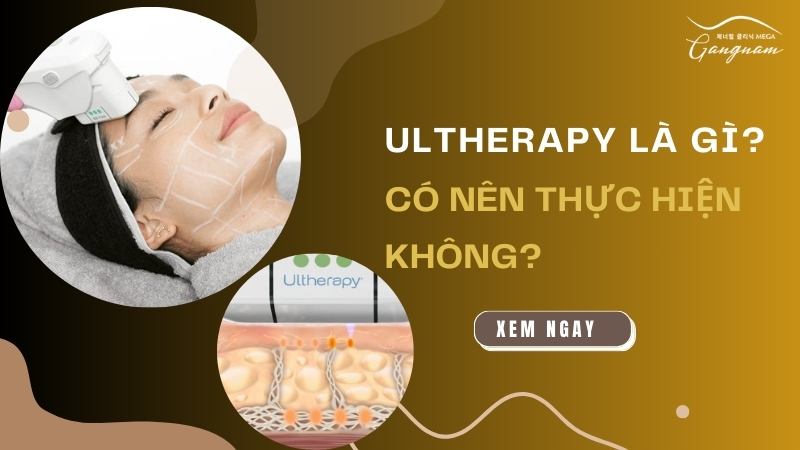 Ultherapy là gì? Có nên thực hiện không?