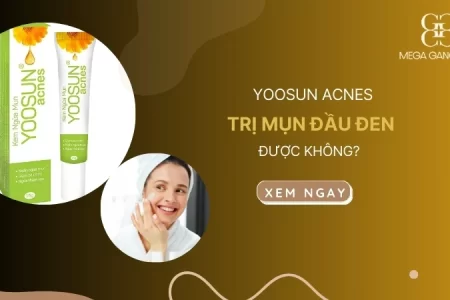 Kem yoosun acnes có trị mụn đầu đen không?