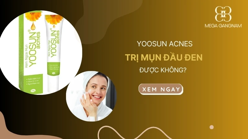 Kem yoosun acnes có trị mụn đầu đen không?