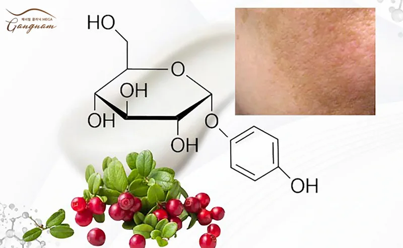 Hiệu quả làm sáng da, ức chế melanin hình thành nám da của arbutin