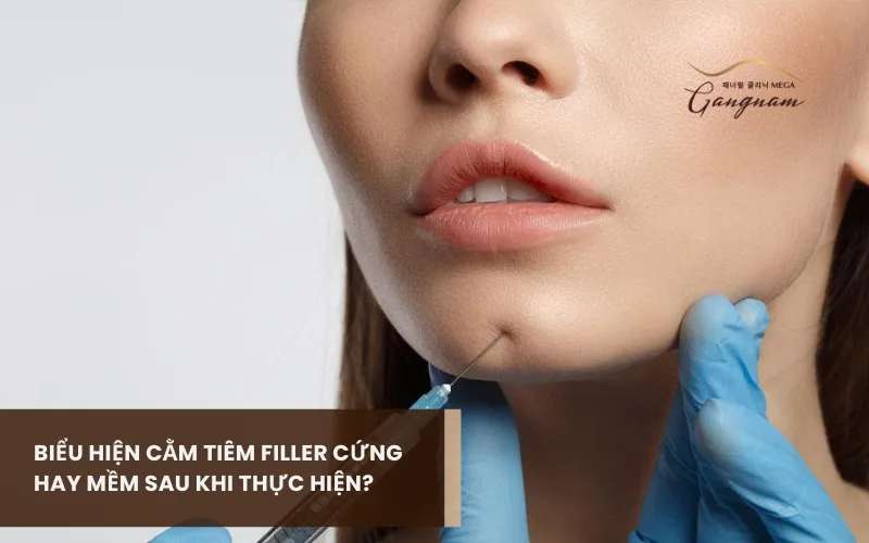 Dấu hiệu cằm tiêm filler cứng hay mềm sau khi thực hiện? Có gì bất thường không? 