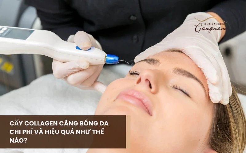 Cấy collagen căng bóng da mặt có những lợi ích gì? Đối tượng nào nên thực hiện? 