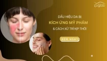 Dấu hiệu da bị kích ứng mỹ phẩm và cách xử trí kịp thời