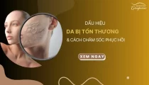 Dấu hiệu da bị tổn thương và cách chăm sóc phục hồi