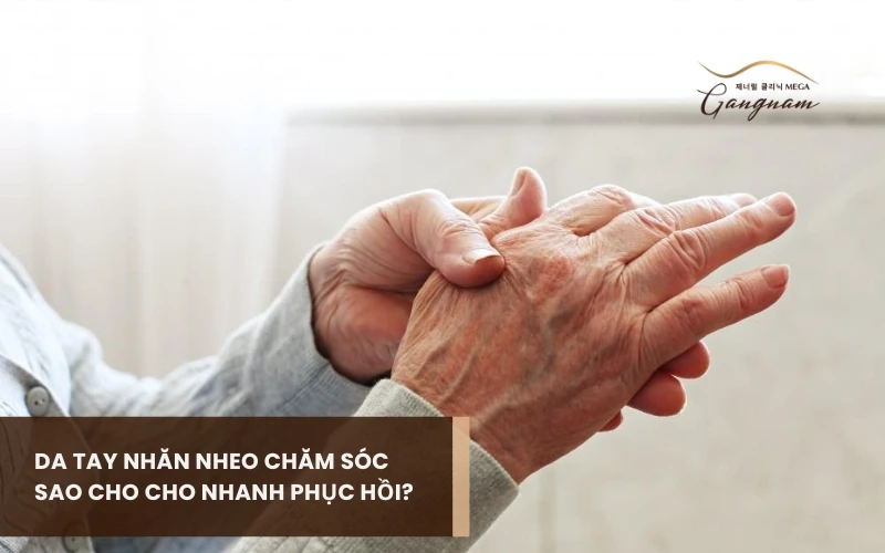 Nguyên nhân khiến da tay nhăn nheo là gì? Chăm sóc sao cho nhanh phục hồi? 