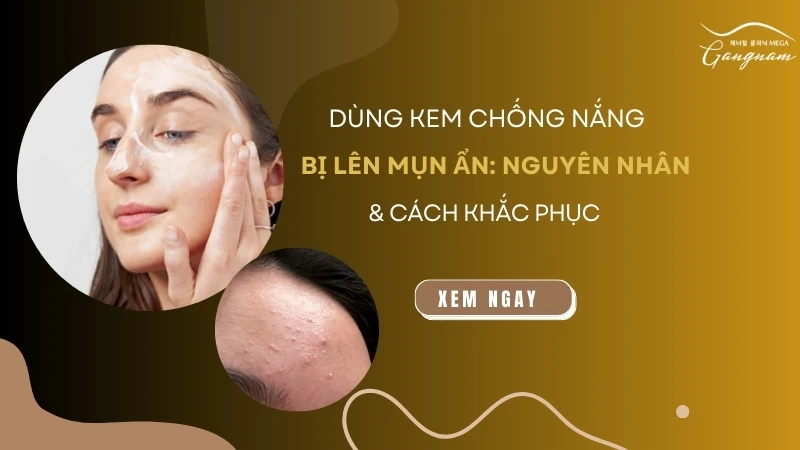 Dùng kem chống nắng bị lên mụn ẩn: Nguyên nhân và cách khắc phục