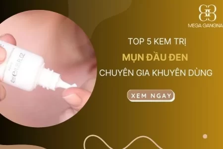 TOP 5 kem trị mụn đầu đen hiệu quả tốt chuyên gia khuyên dùng