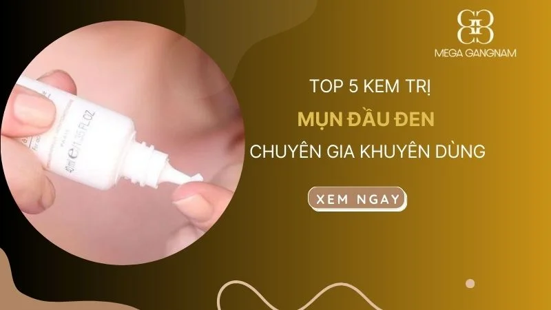 TOP 5 kem trị mụn đầu đen hiệu quả tốt chuyên gia khuyên dùng 