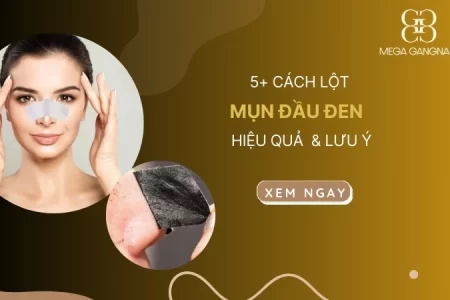 5+ cách lột mụn đầu đen hiệu quả và lời khuyên chuyên gia