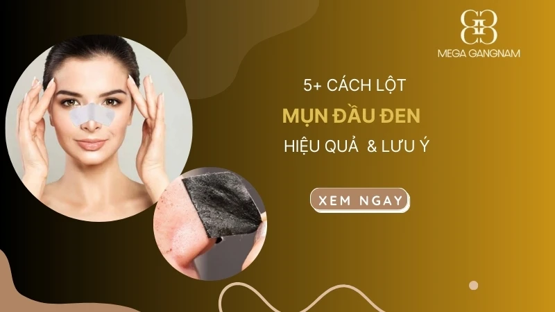 5+ cách lột mụn đầu đen hiệu quả và lời khuyên chuyên gia