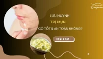 Lưu huỳnh trị mụn có tốt và an toàn không?