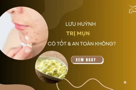 Lưu huỳnh trị mụn có tốt và an toàn không?