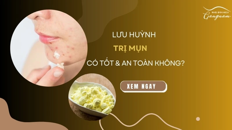 Lưu huỳnh trị mụn có tốt và an toàn không?