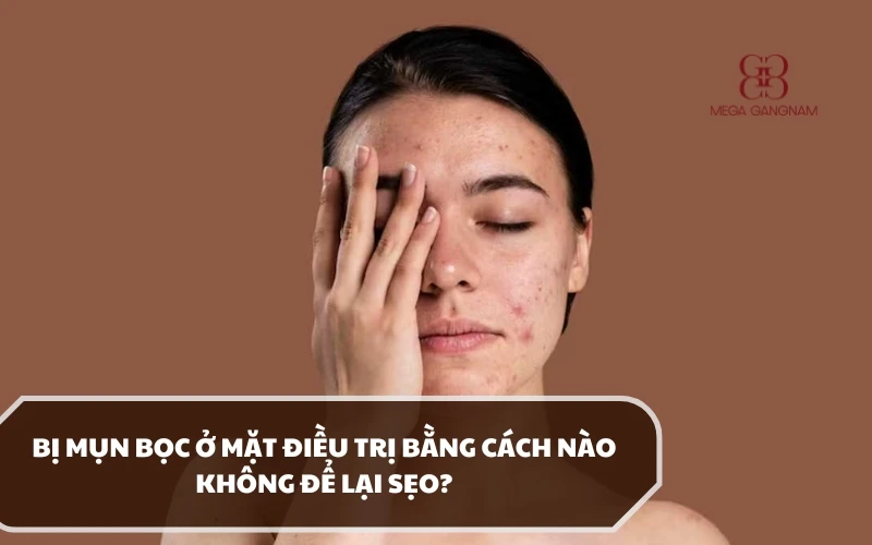 Mụn bọc ở mặt có để lại sẹo không? Áp dụng phương pháp nào để điều trị an toàn? 