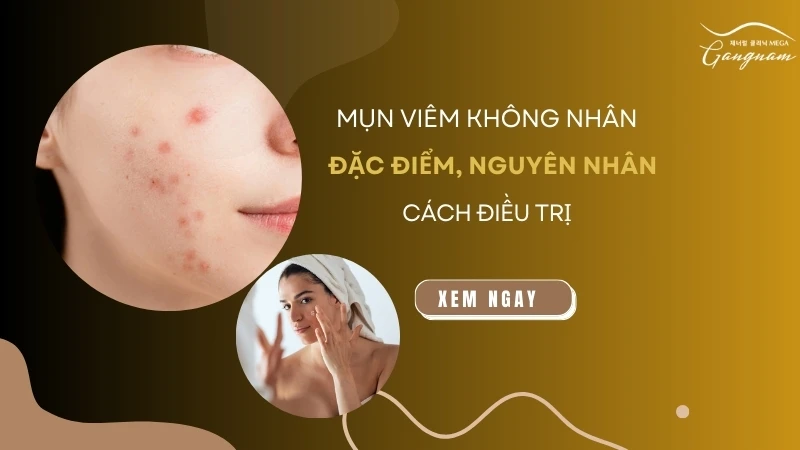 Mụn viêm không nhân: Đặc điểm, nguyên nhân và cách điều trị