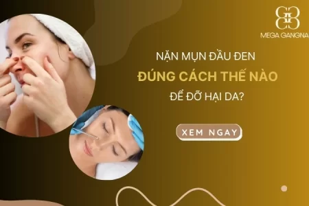 Nặn mụn đầu đen đúng cách thế nào để đỡ hại da?