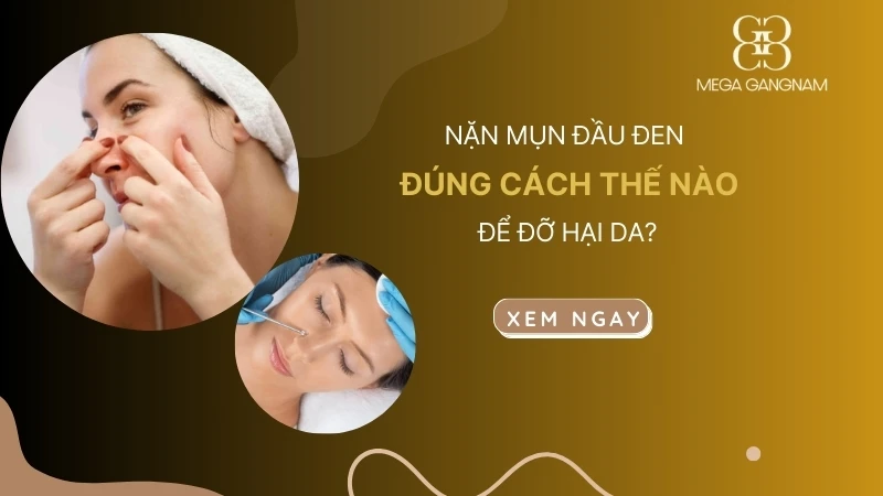 Nặn mụn đầu đen đúng cách thế nào để đỡ hại da?