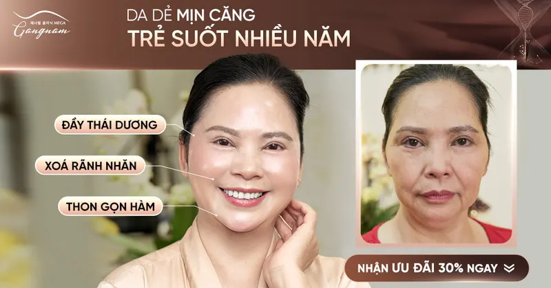 Thon gọn nọng cằm và viền hàm rõ rệt nhờ Meta Elite+