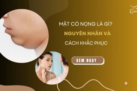 Gương mặt có nọng là gì? Nguyên nhân và cách khắc phục