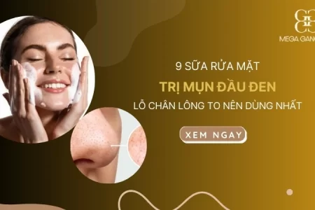 Top 9 sữa rửa mặt trị mụn đầu đen, lỗ chân lông to nên dùng nhất